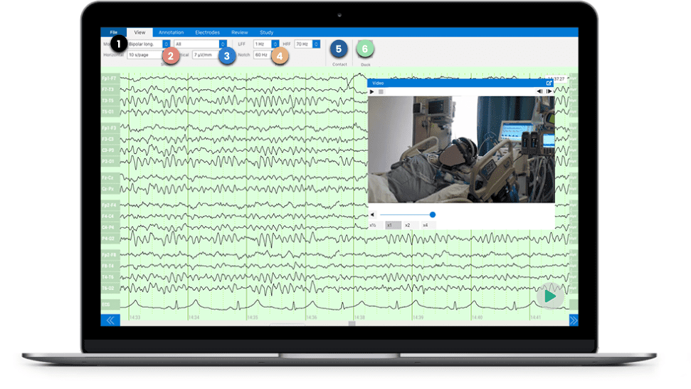 QEEG Brain Mapping Visualization