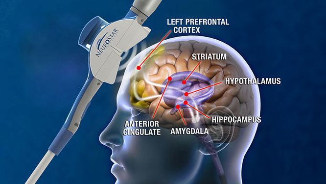 Brain Activity Visualization During TMS