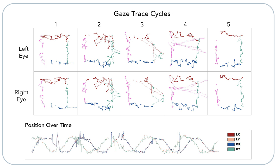 Brain Activity Visualization During Concussion Therapy